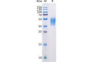 Human B7-H6 Protein, His Tag on SDS-PAGE under reducing condition. (B7-H6 Protein (His tag))