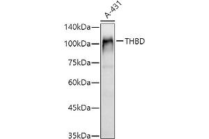 Western blot analysis of extracts of A-431 cells, using THBD antibody (ABIN1683026, ABIN3018621, ABIN3018622 and ABIN6220518) at 1:1000 dilution. (Thrombomodulin Antikörper  (AA 200-500))