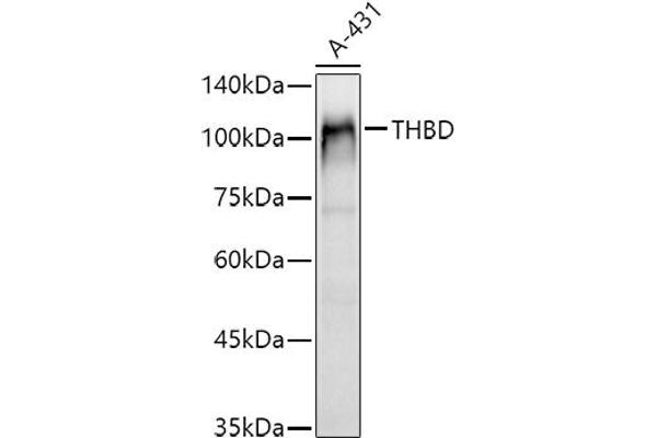 Thrombomodulin 抗体  (AA 200-500)