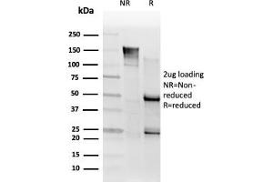 SDS-PAGE Analysis. (SMNDC1 Antikörper)
