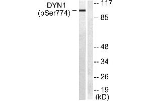 Western blot analysis of extracts from mouse brain cells, using Dynamin-1 (Phospho-Ser774) Antibody (#A0422). (Dynamin 1 Antikörper  (pSer774))