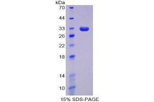 SDS-PAGE (SDS) image for DNA (Cytosine-5)-Methyltransferase 1 (DNMT1) (AA 1343-1570) protein (His tag) (ABIN1878465)
