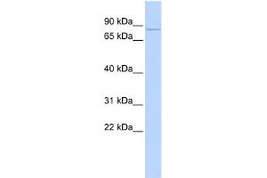 WB Suggested Anti-KCND2 Antibody Titration:  0.