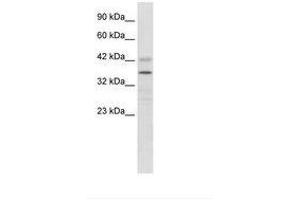 Image no. 2 for anti-Proline Rich 7 (Synaptic) (PRR7) (AA 160-209) antibody (ABIN6735904) (PRR7 Antikörper  (AA 160-209))