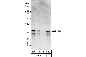 Western Blotting (WB) image for anti-Midline 1 (MID1) (AA 617-667) antibody (ABIN7453135)