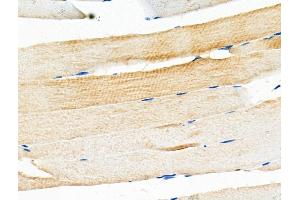 ABIN6259800 and ABIN6276695 at 1/100 staining Mouse muscle tissue by IHC-P. (Adiponectin Receptor 1 Antikörper  (C-Term))