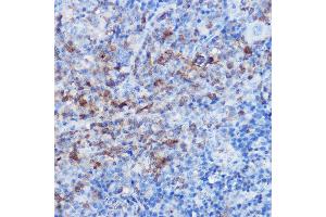 Immunohistochemistry of paraffin-embedded rat spleen using CX3CR1 Rabbit pAb (ABIN3016929, ABIN3016930, ABIN1679440 and ABIN6219885) at dilution of 1:25 (40x lens). (CX3CR1 Antikörper)