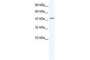 WB Suggested Anti-DMRTB1 Antibody Titration:  5. (DMRTB1 Antikörper  (Middle Region))