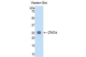 Western Blotting (WB) image for anti-Interleukin 1 Receptor Accessory Protein (IL1RAP) (AA 65-249) antibody (ABIN1176676)