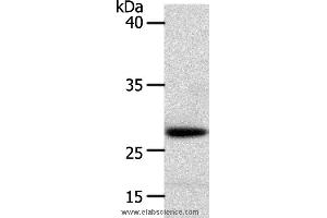 Western blot analysis of Human liver cancer tissue, using RARRES1 Polyclonal Antibody at dilution of 1:300 (RARRES1 Antikörper)