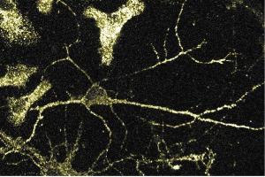 Immunofluorescence staining of rat neurons. (alpha Adaptin Antikörper  (AA 38-215))