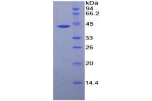 SDS-PAGE (SDS) image for Creatine Kinase, Muscle (CKM) ELISA Kit (ABIN6574139)