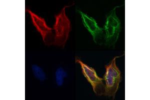 ABIN6260703 and ABIN6268787 staining Hela by IF/ICC.