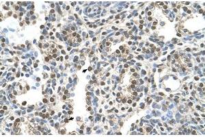 Immunohistochemical staining (Formalin-fixed paraffin-embedded sections) of human lung with MAGEA8 polyclonal antibody . (MAGEA8 Antikörper  (AA 51-100))
