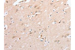 The image on the left is immunohistochemistry of paraffin-embedded Human brain tissue using ABIN7131058(SIGLEC9 Antibody) at dilution 1/40, on the right is treated with fusion protein. (SIGLEC9 Antikörper)