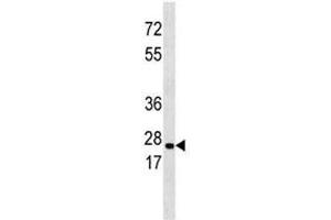 ERAB antibody western blot analysis in 293 lysate (Endoplasmic Reticulum Amyloid Binding Protein (ERAB) (AA 199-235) Antikörper)