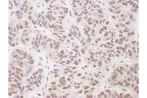 anti-BCL2-Associated Transcription Factor 1 (BCLAF1) (AA 150-200) antibody