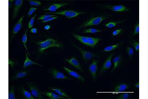 Immunofluorescence of purified MaxPab antibody to ATP5O on HeLa cell. (ATP5O Antikörper  (AA 1-213))