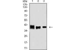 Western blot analysis using ALDOA mouse mAb against MCF-7 (1), Hela (2), and NIH/3T3 (3) cell lysate. (ALDOA Antikörper  (AA 9-145))