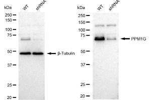 Western blotting analysis using PPM1G antibody (ABIN7800034). (Rekombinanter PPM1G Antikörper)