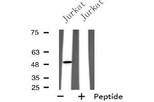 Western blot analysis of extracts from Jurkat cells, using GPR142 antibody. (GPR142 Antikörper  (Internal Region))