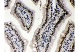 IHC testing of FFPE mouse intestine with CSNK1A1 antibody. (CSNK1A1 Antikörper)