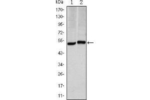 Western blot analysis using CA9 mouse mAb against Hela (1) and A549 (2) cell lysate. (CA9 Antikörper)