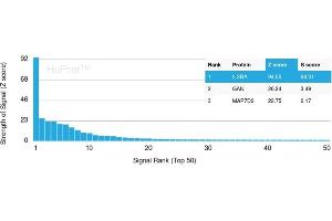 Analysis of Protein Array containing more than 19,000 full-length human proteins using IL3RA / CD123 Rabbit Recombinant Monoclonal Antibody (IL3RA /2947R). (Rekombinanter IL3RA Antikörper  (AA 26-171))