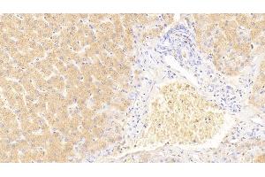 Immunohistochemistry (IHC) image for anti-serpin Peptidase Inhibitor, Clade E (Nexin, Plasminogen Activator Inhibitor Type 1), Member 2 (SERPINE2) (AA 20-398) antibody (ABIN7442000)