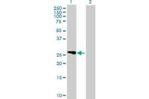 Western Blot analysis of FLJ25006 expression in transfected 293T cell line by FLJ25006 MaxPab polyclonal antibody. (FLJ25006 (AA 1-274) Antikörper)