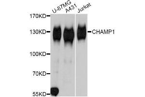 Western blot analysis of extracts of various cell lines, using CHAMP1 Antibody. (ZNF828 Antikörper  (AA 563-812))