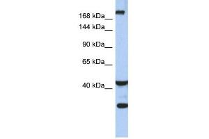 DISP1 antibody used at 1 ug/ml to detect target protein. (DISP1 Antikörper)