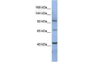 WB Suggested Anti-RBM12 Antibody Titration:  0.