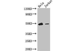 Western Blot Positive WB detected in: Hela whole cell lysate, Jurkat whole cell lysate All lanes: IKZF1 antibody at 3. (IKZF1 Antikörper  (AA 1-265))