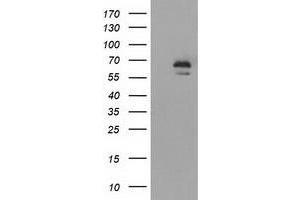 Western Blotting (WB) image for anti-Insulin-Like Growth Factor 2 mRNA Binding Protein 2 (IGF2BP2) antibody (ABIN1498826) (IGF2BP2 Antikörper)