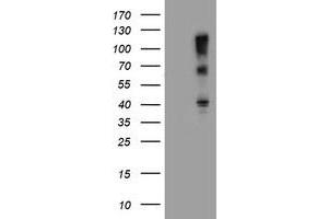 Western Blotting (WB) image for anti-F-Box Protein 31 (FBXO31) antibody (ABIN1498239) (FBXO31 Antikörper)