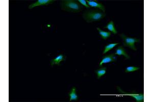 Immunofluorescence of purified MaxPab antibody to PAK6 on HeLa cell. (PAK6 Antikörper  (AA 1-681))