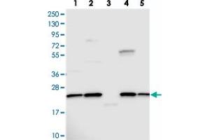 Western blot analysis of Lane 1: RT-4, Lane 2: U-251 MG, Lane 3: Human Plasma, Lane 4: Liver, Lane 5: Tonsil with NPVF polyclonal antibody . (NPVF Antikörper)