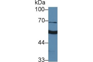 Western Blotting (WB) image for anti-4-Aminobutyrate Aminotransferase (ABAT) (AA 236-500) antibody (ABIN7445057)