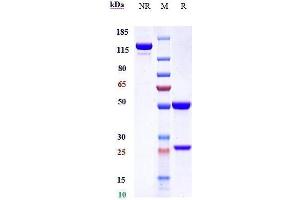 Anti-CD14 Reference Antibody (atibuclimab) on SDS-PAGE under reducing (R) condition.