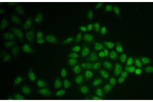 Immunofluorescence analysis of U2OS cells using BTG1 Polyclonal Antibody (BTG1 Antikörper)