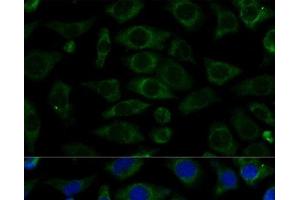 Immunofluorescence analysis of L929 cells using NDUFB7 Polyclonal Antibody at dilution of 1:100 (40x lens). (NDUFB7 Antikörper)