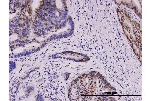 Immunostaining (ISt) image for anti-Wilms Tumor 1 (WT1) (AA 349-439) antibody (ABIN521406)