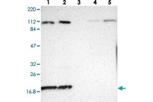Western blot analysis of Lane 1: RT-4, Lane 2: U-251 MG, Lane 3: Human Plasma, Lane 4: Liver, Lane 5: Tonsil with RPL12 polyclonal antibody  at 1:250-1:500 dilution. (RPL12 Antikörper)