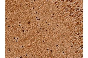 ABIN6276980 at 1/200 staining human brain tissue sections by IHC-P. (TRIM21 Antikörper  (C-Term))