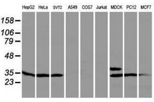 Image no. 1 for anti-Protein tyrosine Phosphatase, Non-Receptor Type 7 (PTPN7) antibody (ABIN1500502) (PTPN7 Antikörper)