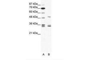 Image no. 1 for anti-Zinc Finger Protein 488 (ZNF488) (C-Term) antibody (ABIN202284) (ZNF488 Antikörper  (C-Term))