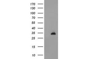 Image no. 1 for anti-CTD (Carboxy-terminal Domain, RNA Polymerase II, Polypeptide A) Small Phosphatase 1 (CTDSP1) antibody (ABIN1497680)
