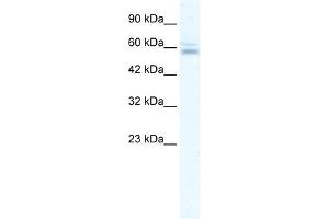 WB Suggested Anti-ZNF141 Antibody Titration:  2. (ZNF141 Antikörper  (N-Term))
