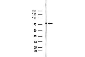 anti-Tyrosine Kinase, Non-Receptor, 1 (TNK1) (N-Term) antibody